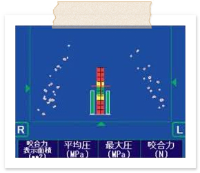 かみ合わせ診断機　画面